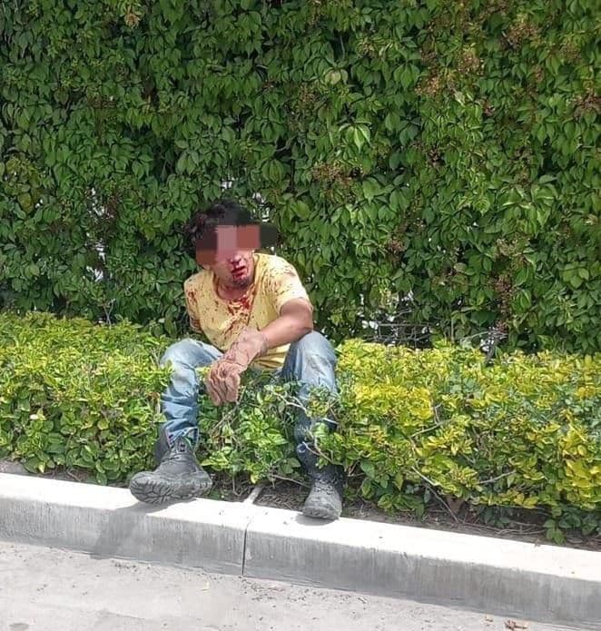 Repartidor es agredido a machetazos frente a hotel Encore