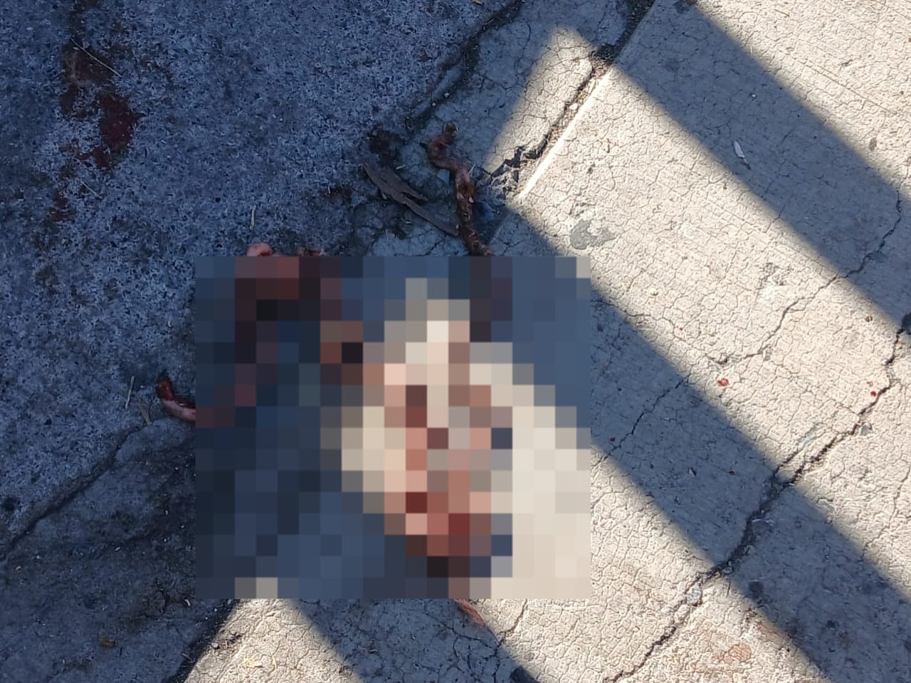 Alarma a potosinos hallazgo de restos humanos fuera del Hospital Central