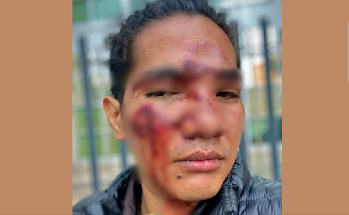 Denuncia joven violenta golpiza en antro