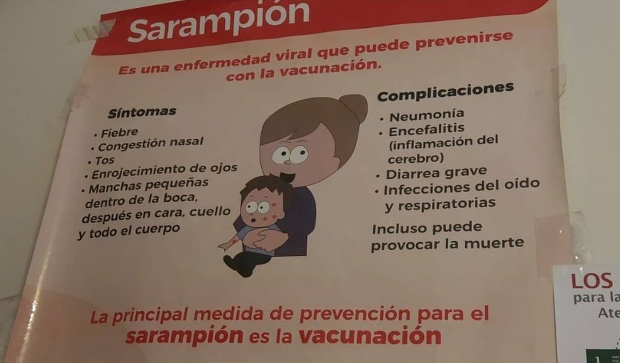 Descartan brote de sarampión en escuela; fue varicela