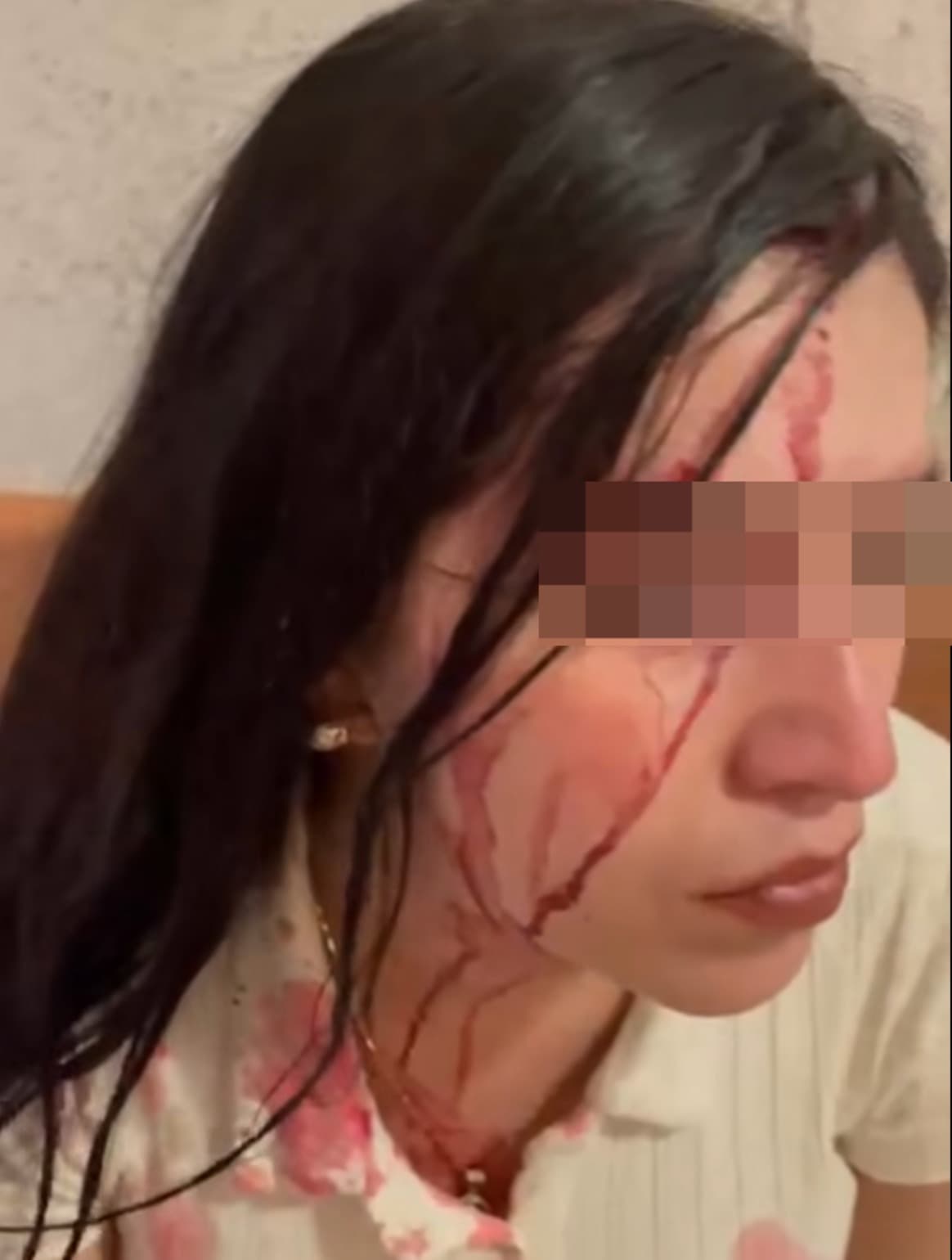 Guardia del Hospital Central agrede con tolete a mujer