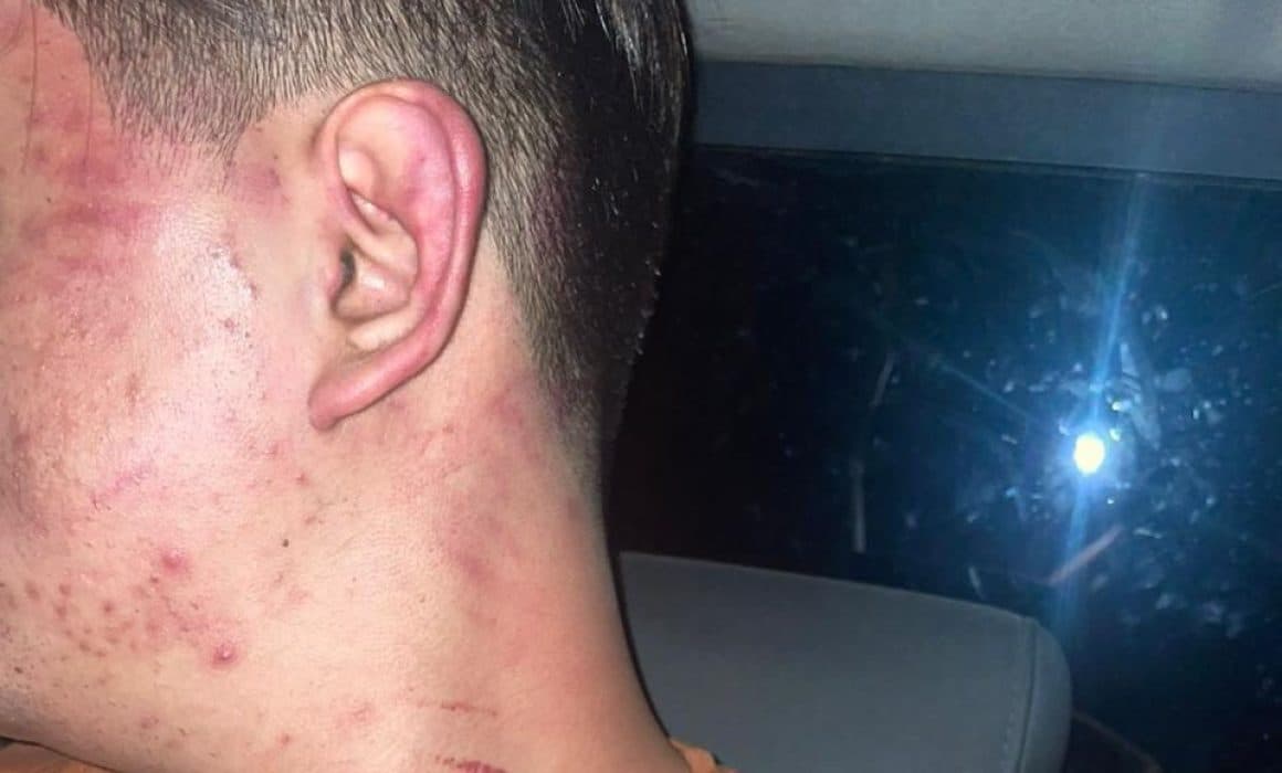 Denuncia joven en Michoacán a Ignacio Mendoza Jiménez por secuestro y tortura