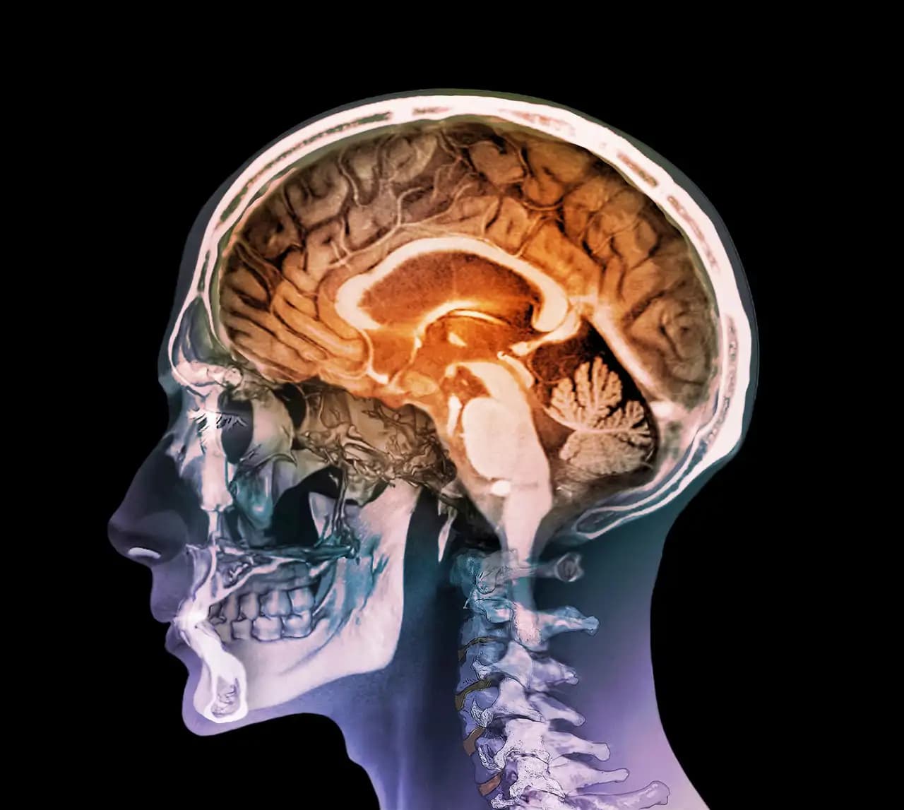Aplican técnicas de la cosmología para escuchar la estructura del cerebro humano